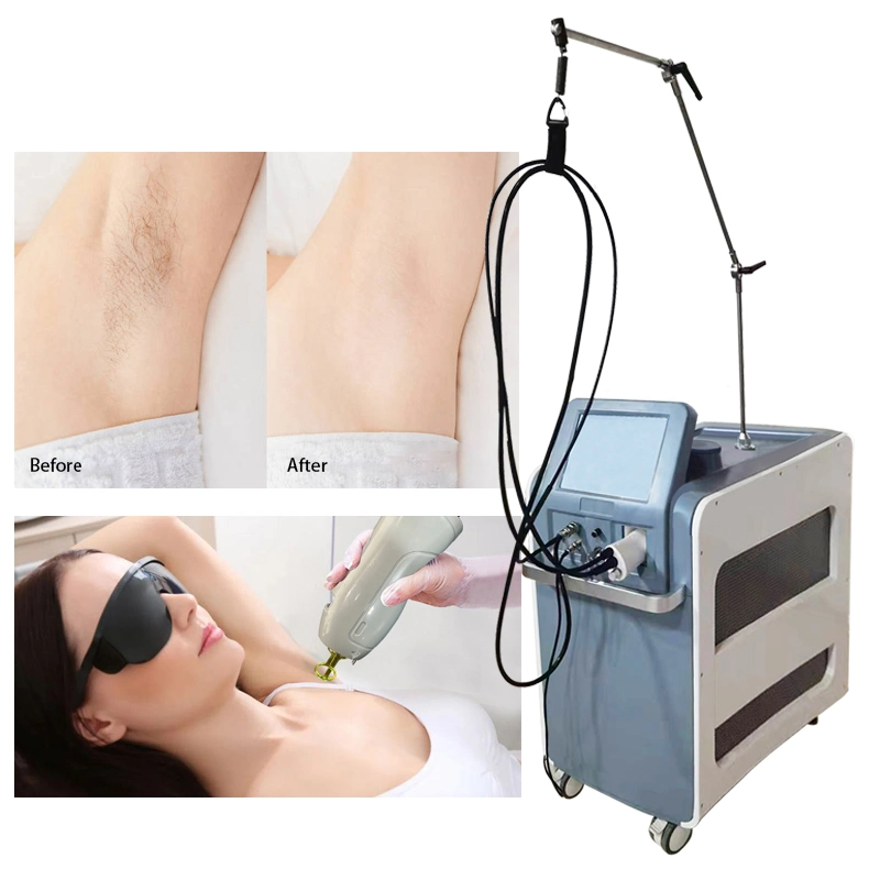 2021 New Hair Removal Machine Long Pulsed ND YAG Laser 1064nm Alexandrite 755nm Laser